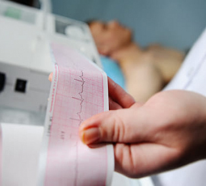 ЭКГ в 12 отведениях