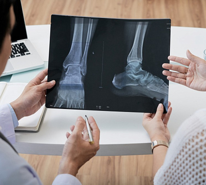 Рентген пяточной кости