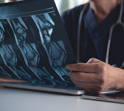 Рентген коленного сустава